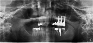 Case #3 Final